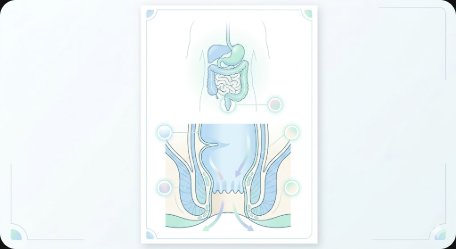 2026 치질(치핵) 완벽 가이드 — 초기 증상·원인·내치핵 vs 외치핵 차이·자가 관리법·약물 치료·수술 종류·재발 방지까지 총정리
